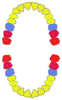 ４月からCAD/CAMインレーが保健適用になります
